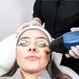 Can Hair Be Permanently Removed by Laser?