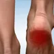 Heel Pain: Causes, Treatments, and Prevention
