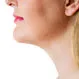 How Long Does Kybella Last?