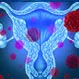 What Were Your First Signs of Uterine Cancer?