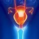 Who Is at High Risk for Ovarian Cancer?