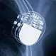 Is Pacemaker Implantation a Major Surgery?