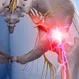 What Are the 4 Types of Sciatica?